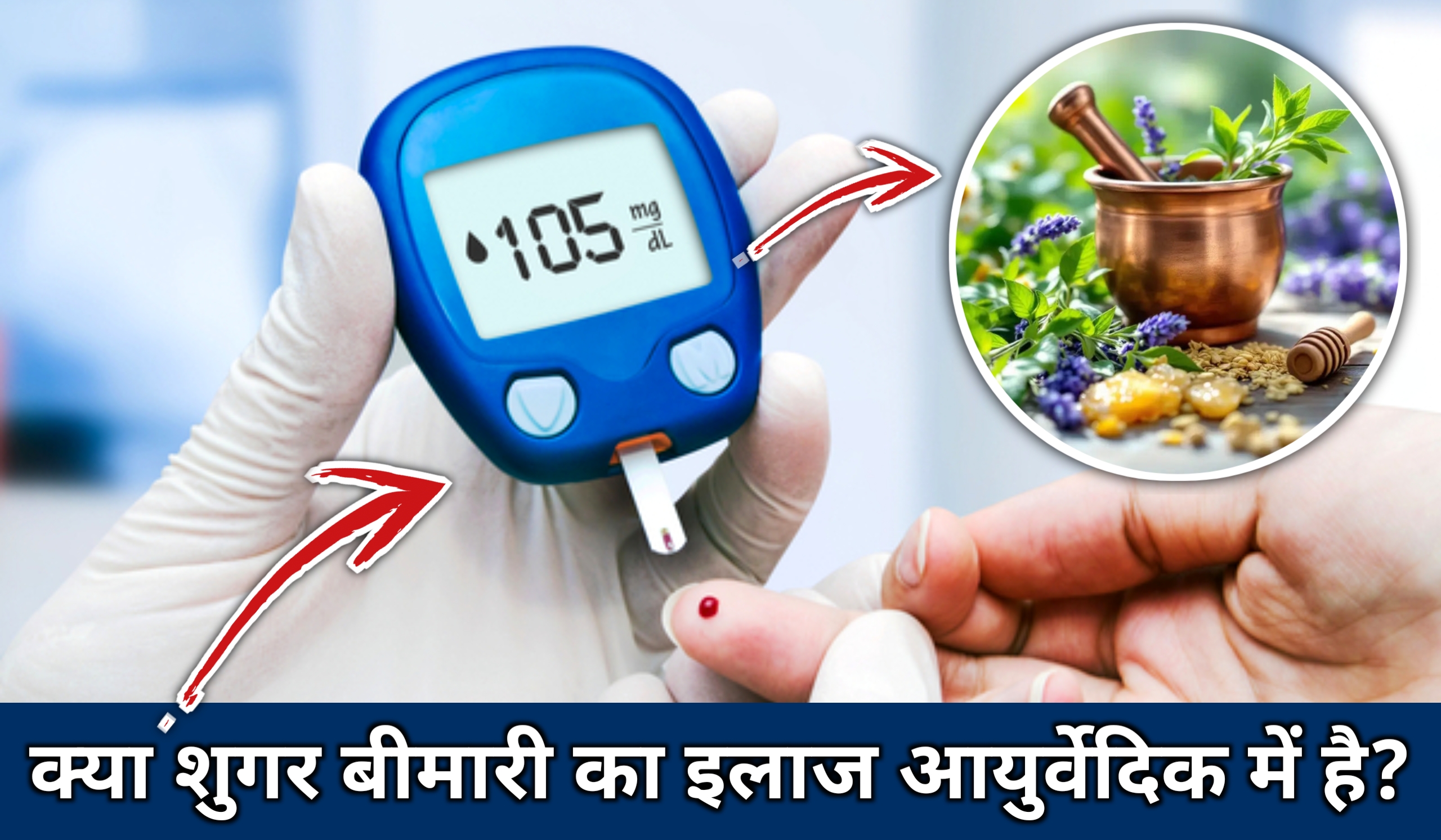 क्या शुगर बीमारी का इलाज आयुर्वेदिक में है?